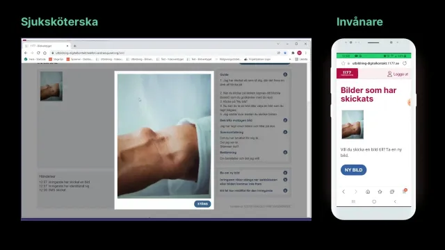 Stillbild ur utbildningsfilmen: Sjuksköterskans bildverktyg till vänster och invånarens telefon till höger: den som ringer har skickat en bild på sin arm, och sjuksköterskan ser den bredvid en guide för samtalet.